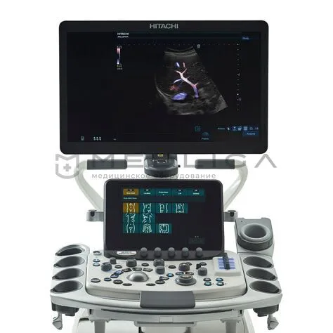 УЗИ аппараты Ультразвуковой аппарат Fujifilm (Hitachi) Arietta 850