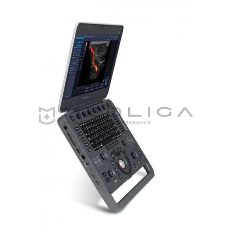 УЗИ сканер SonoScape S2N