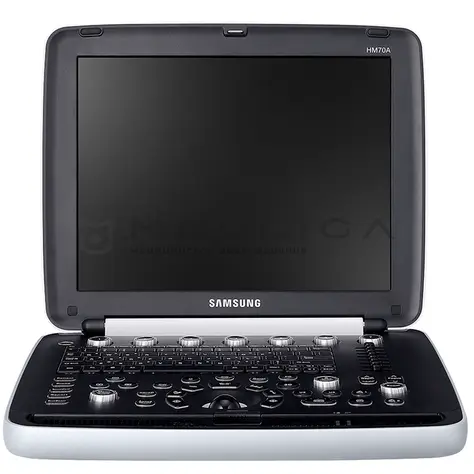 Портативный УЗИ сканер Samsung HM70a