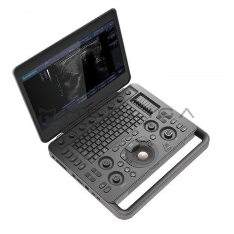 УЗИ сканер SonoScape S2N