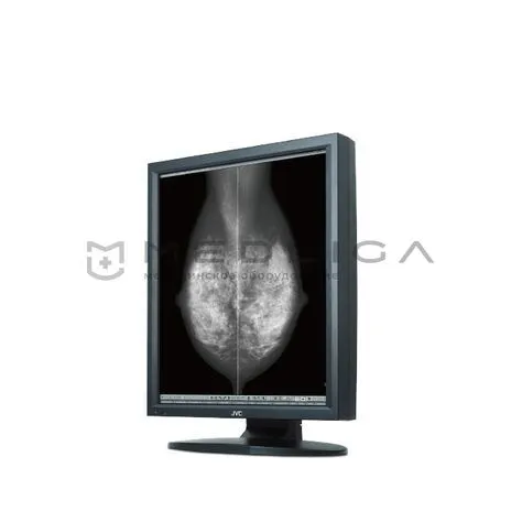 Медицинский монитор JVC MS55i2 plus
