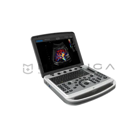 УЗИ аппарат Chison SonoTouch 80 (SonoBook 6)