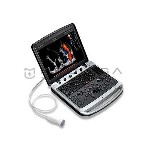 УЗИ аппарат CHISON SonoBook 9