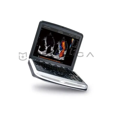 УЗИ аппарат CHISON SonoBook 9
