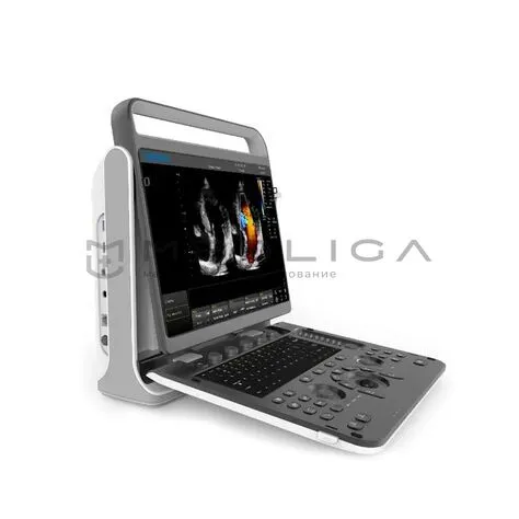 Ультразвуковой аппарат Chison SonoTouch 60 Pro