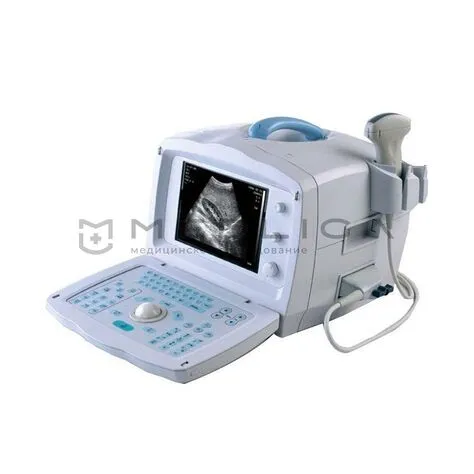УЗИ аппарат Mindray DP 1100