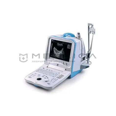 УЗИ аппарат Mindray DP 3300