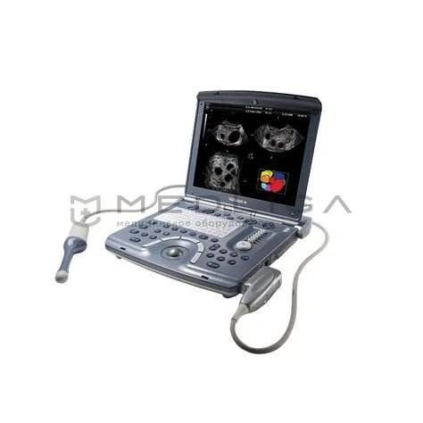 Портативный ультразвуковой аппарат GE Healthcare Voluson E