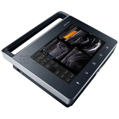 УЗИ аппарат Samsung PT60