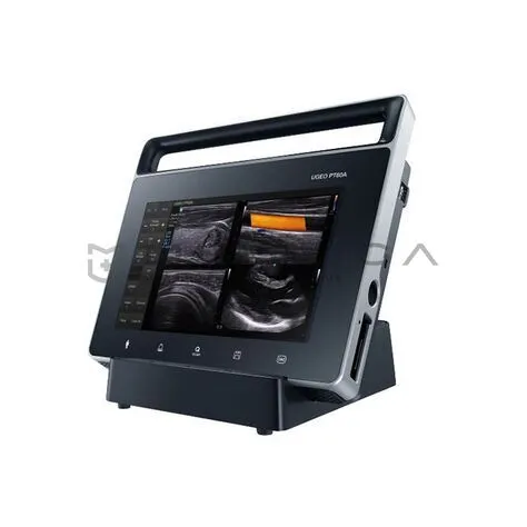 УЗИ аппарат Samsung PT60