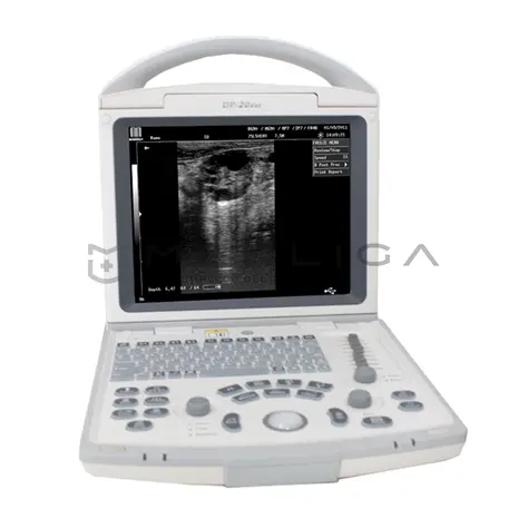 УЗИ система Mindray DP-20
