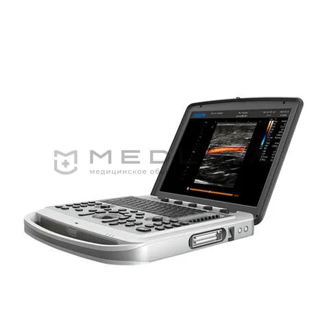 УЗИ аппарат Chison SonoTouch 80 (SonoBook 6)
