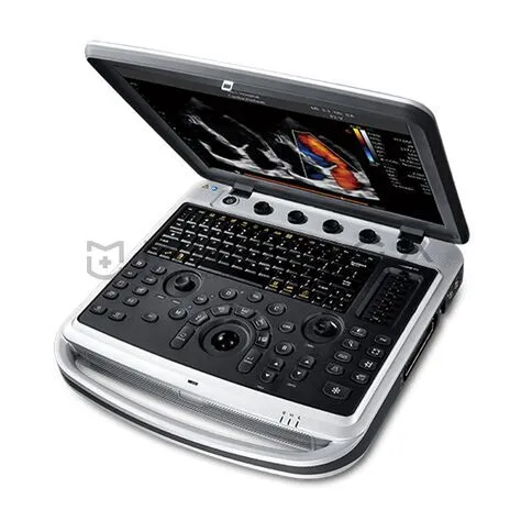 УЗИ аппарат Chison SonoTouch 80 (SonoBook 8)