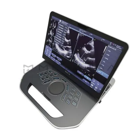 Портативная ультразвуковая система GE Healthcare Vivid iQ