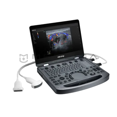 УЗИ аппарат Mindray MX3