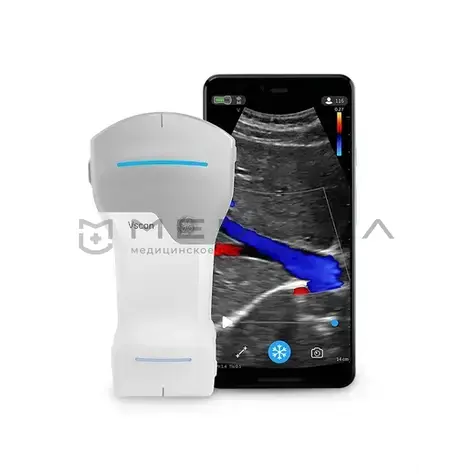 УЗИ аппарат GE HealthCare Vscan Air