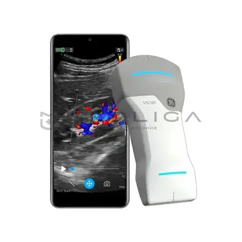 УЗИ аппарат GE HealthCare Vscan Air