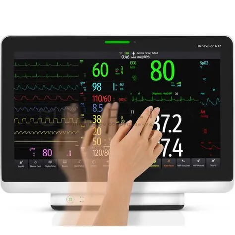 Монитор пациента Mindray BeneVision N17