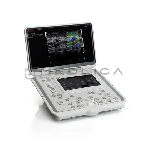 УЗИ аппарат Esaote MyLab Omega